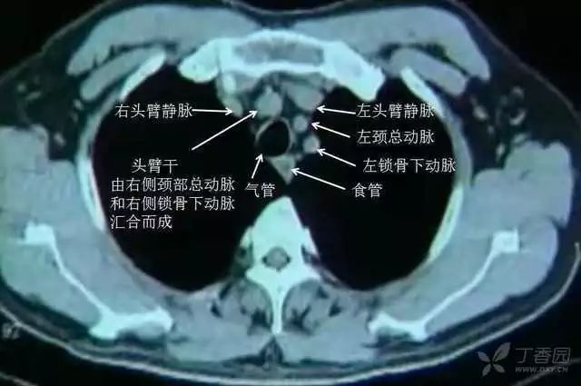 掌握胸部 ct 影像,你只差这一个图谱的距离