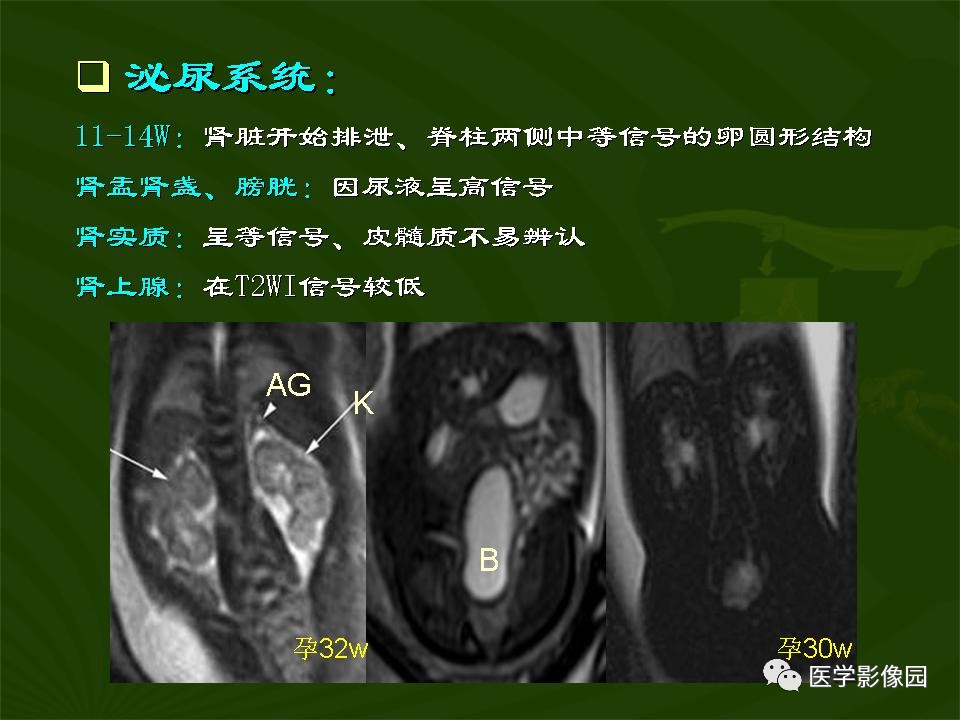 胎兒腹部mri在腹部與盆腔中的臨床應用及評價丨影像天地