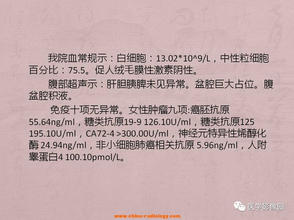 降结肠低分化腺癌伴双侧附件区种植转移等你分析丨读片专栏672期