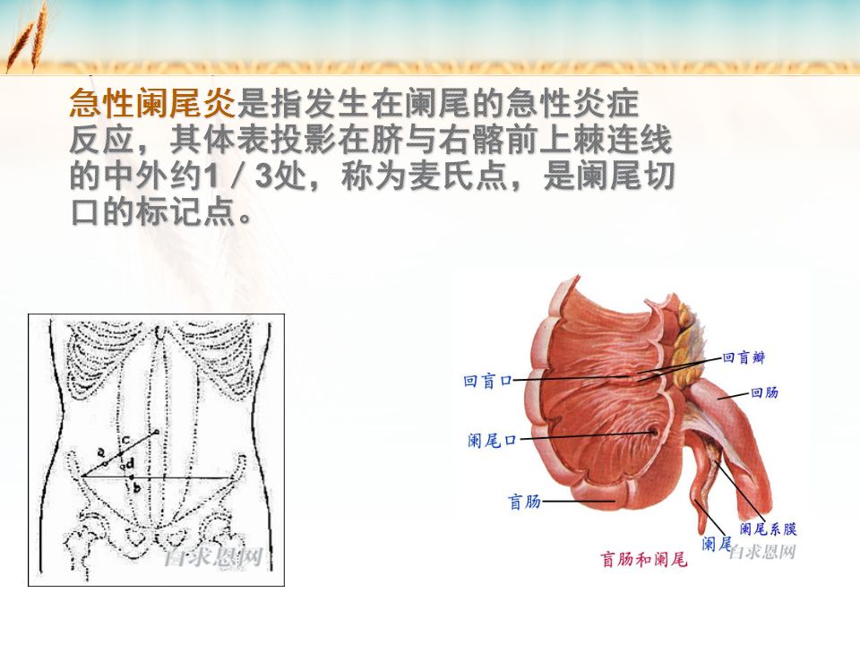 阑尾生理解剖位置图片