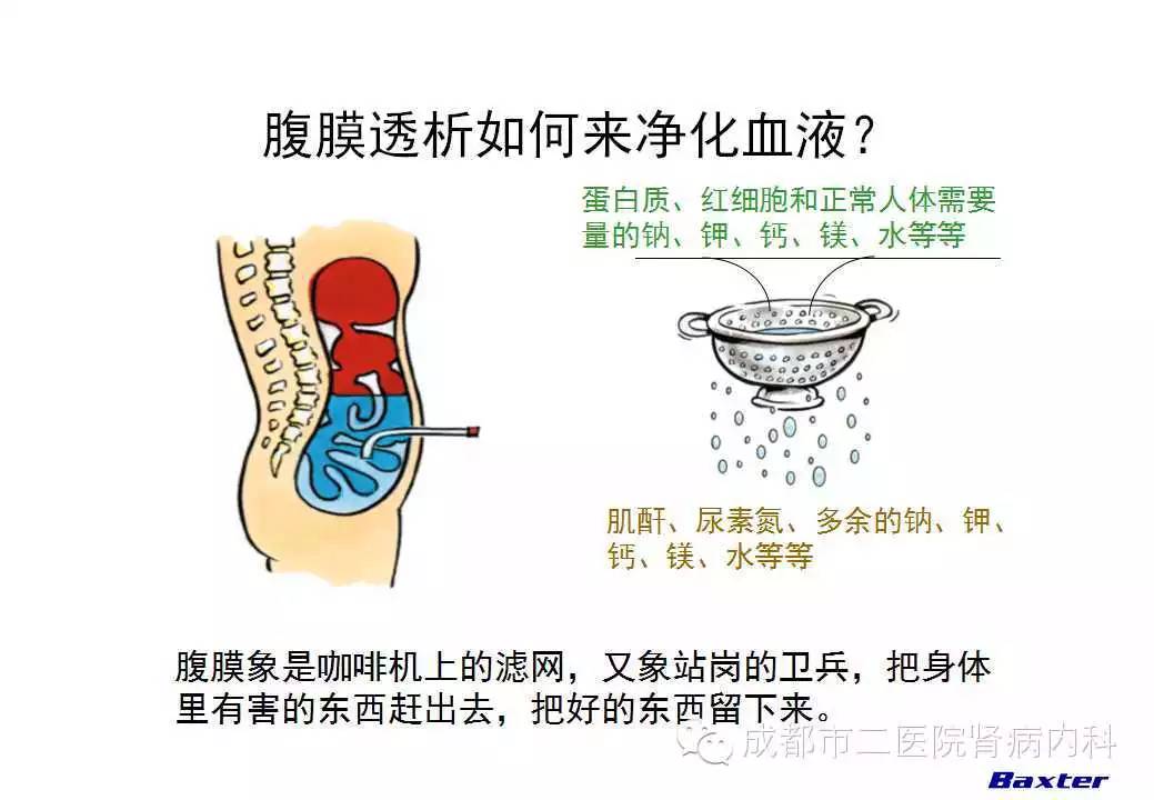 腹透和血透哪种更好图片