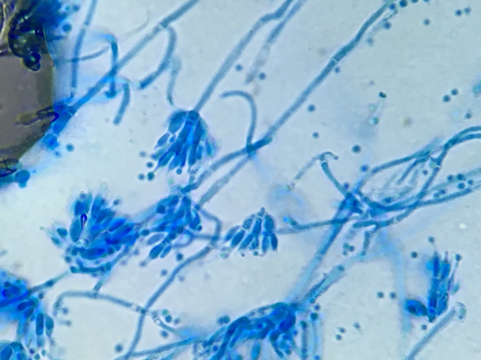 马尔尼菲蓝状菌图图片