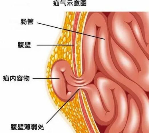 漏肠的症状图片