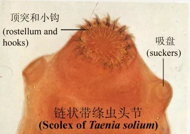 猪带绦虫头节绘图图片