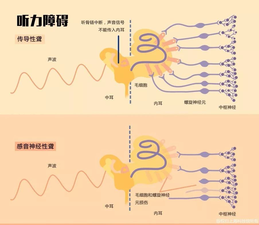 听觉中枢传导通路图图片