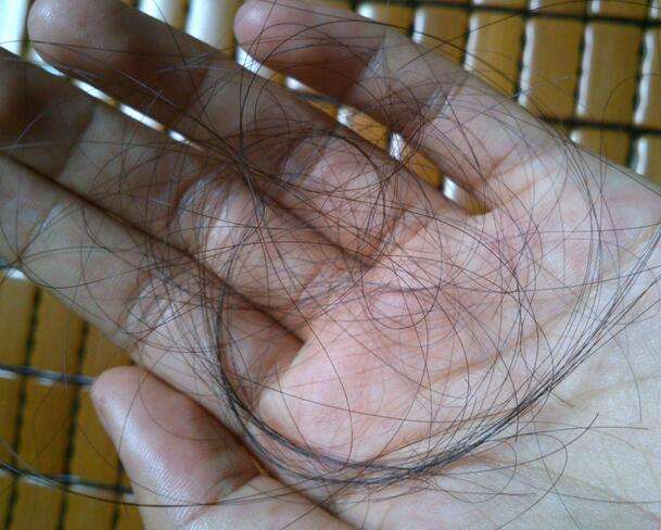 而脱发是毛囊生发能力下降,出现脱发也是一根一根掉发,所以脱发者会