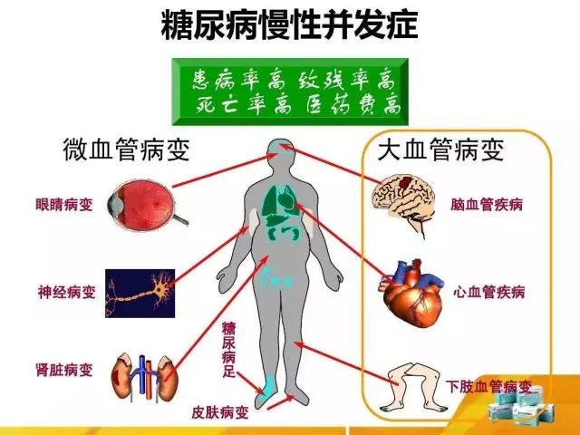 这些身体信号,提示糖尿病出现了并发症!