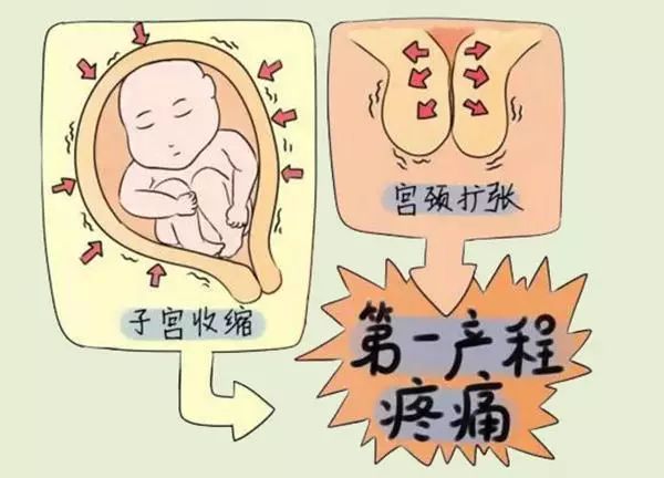 產婦準備:宮頸從0開到3指,速度比較慢,這個階段孕婦可以吃一點食物