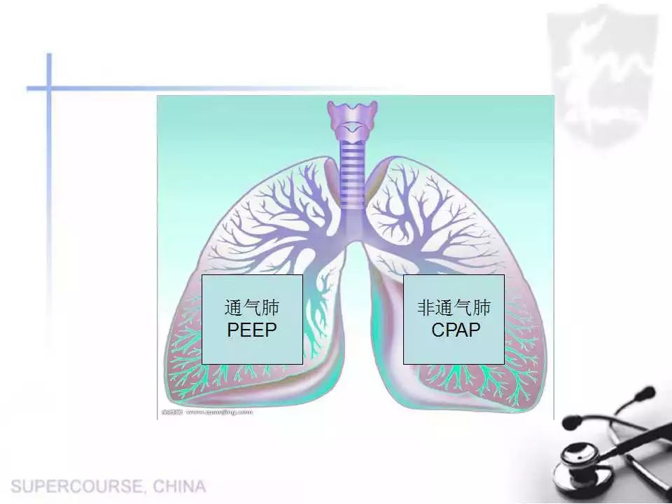 週三晨課-單肺通氣肺保護策略