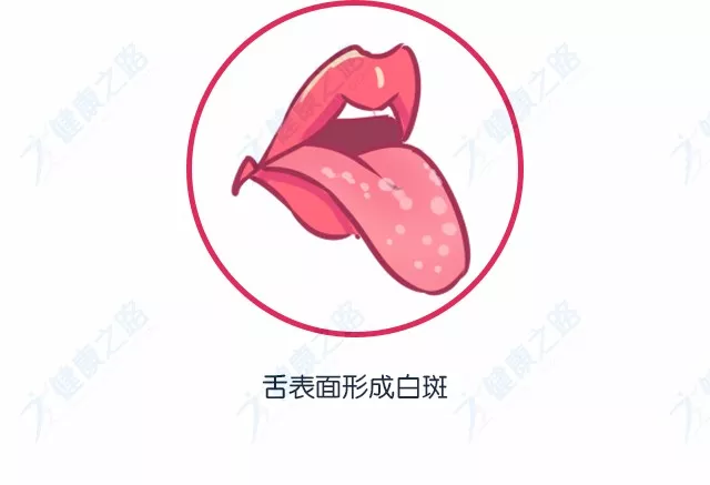 看看自己的舌頭如果是這種顏色就要注意啦