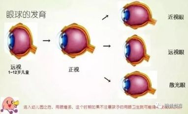 行业分析效果篇之有效才是硬道理—确实提升了弱视,远视,近视的裸眼