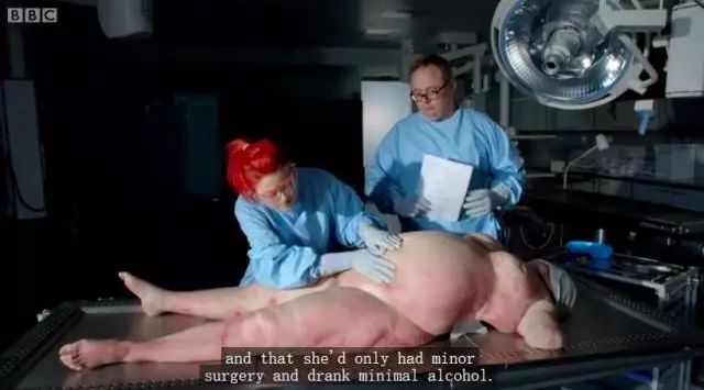 解剖肥胖者的纪录片图片