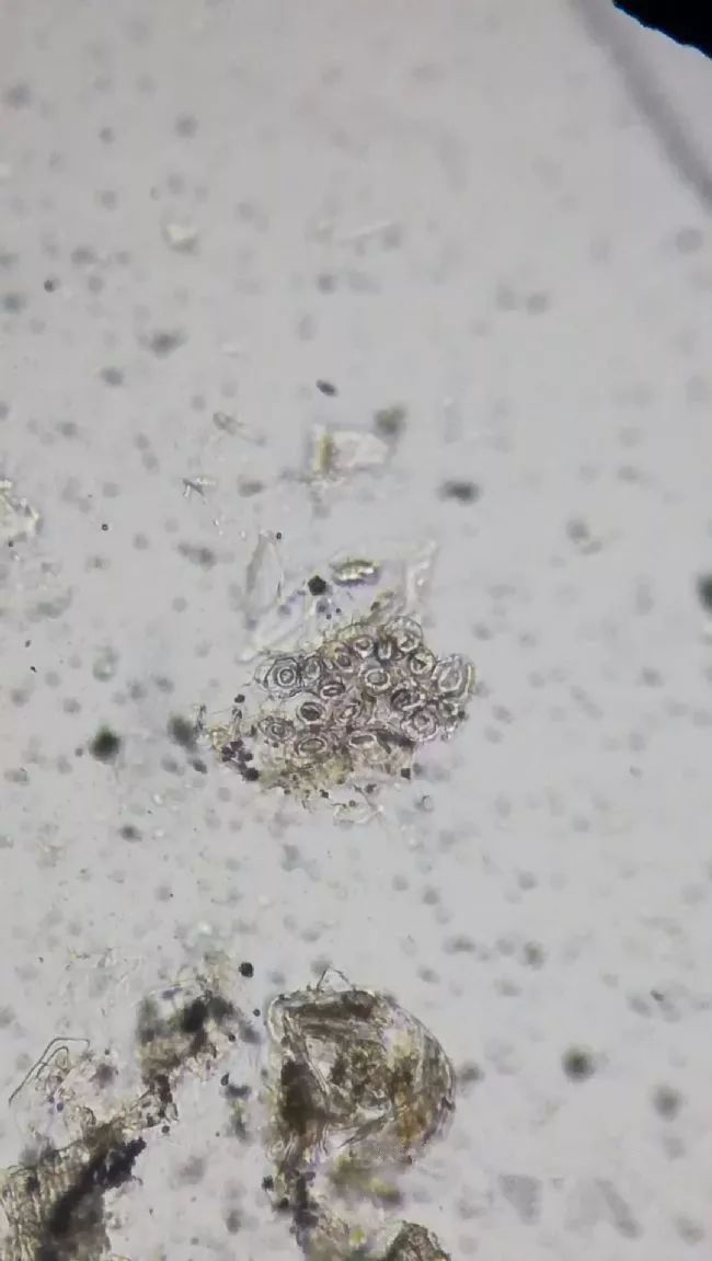 鸽子毛滴虫显微镜图片图片