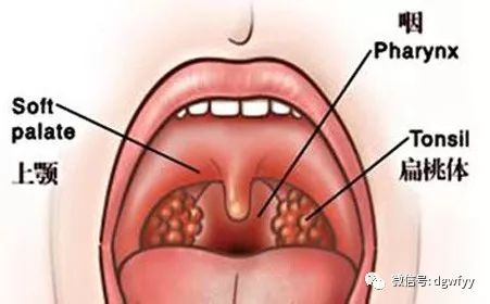 小儿急性喉炎易肿胀发生喉阻塞容易造成危害宝爸妈要千万不可大意
