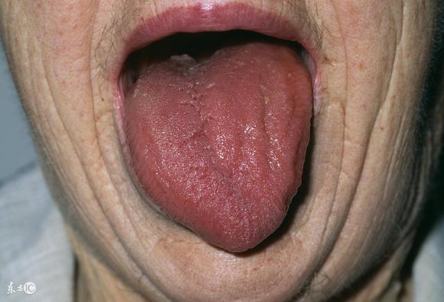 学会中医看舌质舌苔,最直接的身体警示灯!
