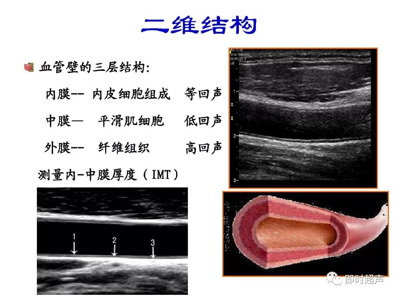 颈部血管超声正常解剖及常见病的超声诊断标准