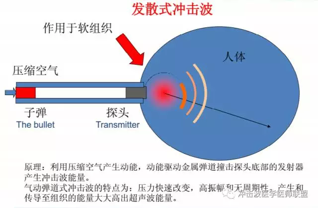 骨肌疾病体外冲击波疗法(eswt)中国专家共识(第2版)(下)