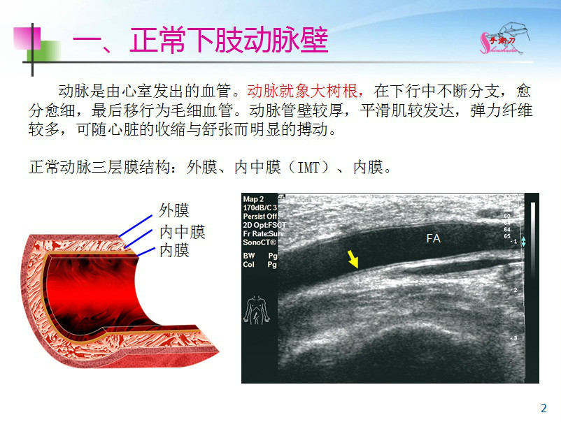 下肢血管解剖图 彩超图片