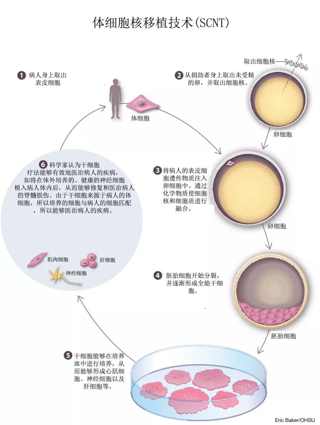 體細胞核移植技術(scnt)克隆胚胎幹細胞流程圖