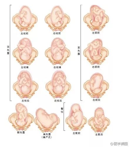 22种胎位图解图片