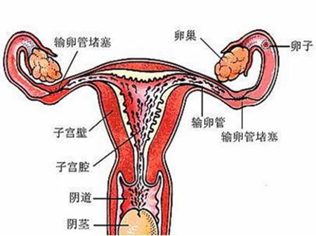 子宫和宫腔的位置图图片