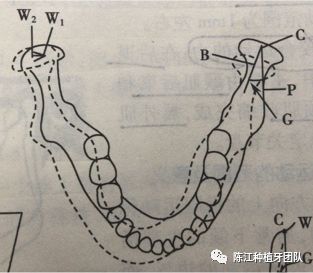 髁导斜度图片图片