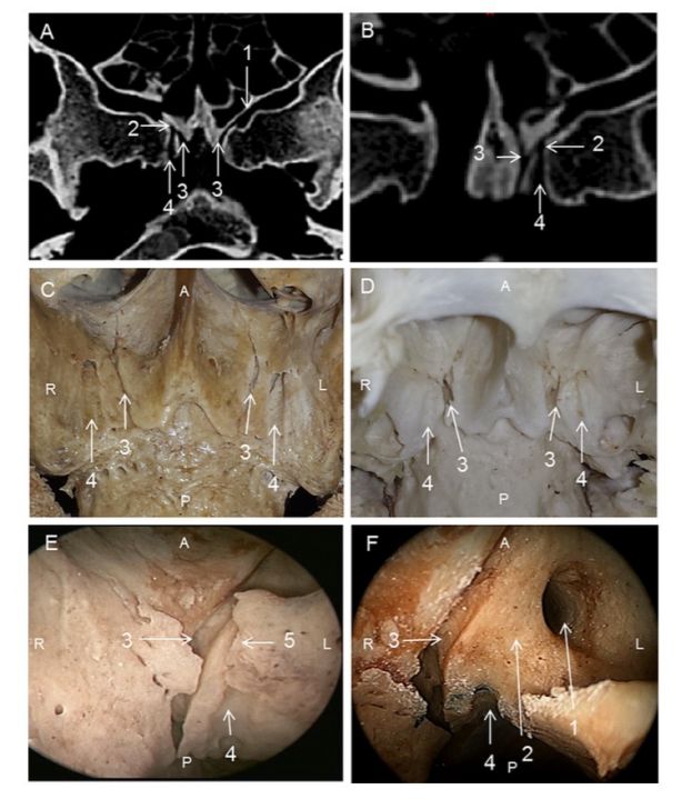 palatoalveolar图片