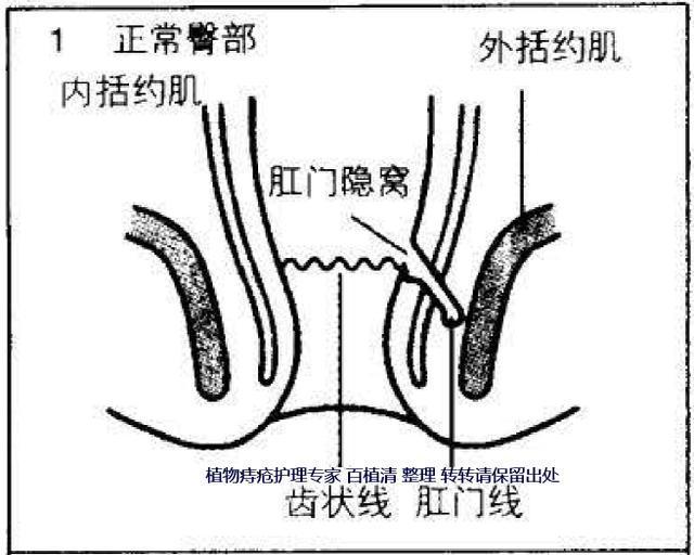 痔瘘是什么症状图片