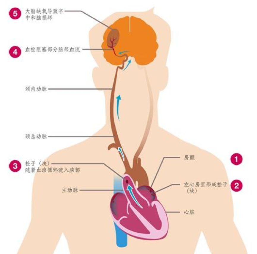 跨世紀的 framingham 心臟研究 | 協和八