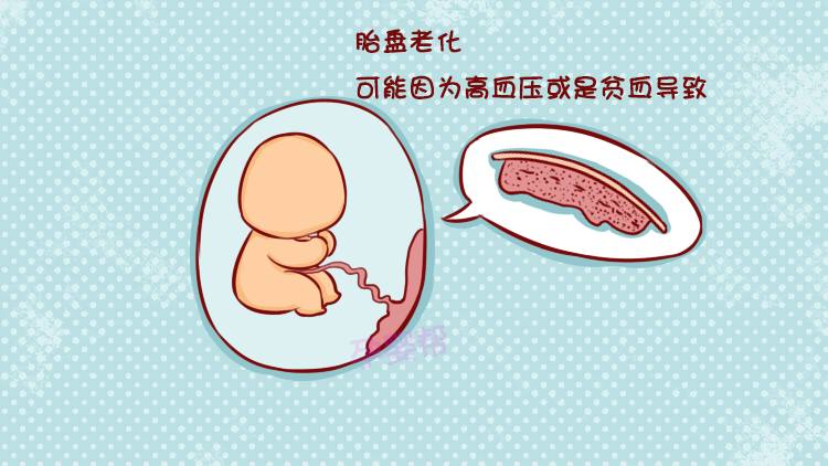 孕23周胎盘成熟1级什么意思?最详细的胎盘分析全在这里