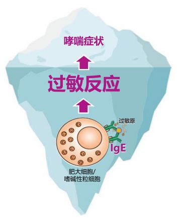 过敏性哮喘老不好?这里有一个方法,能帮到你!