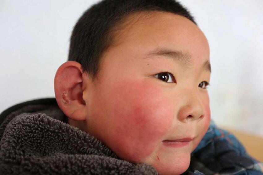 河南南阳:小学校烧柴取暖 有的孩子被冻伤