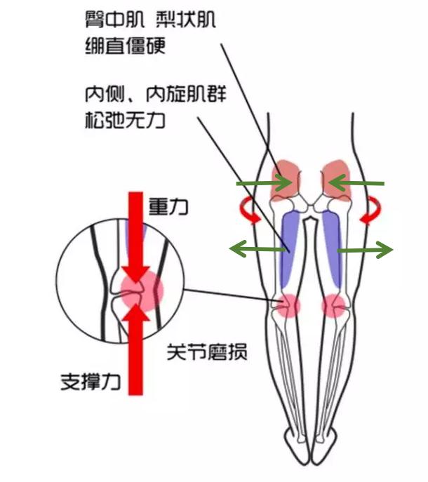 腿从哪里算起图片