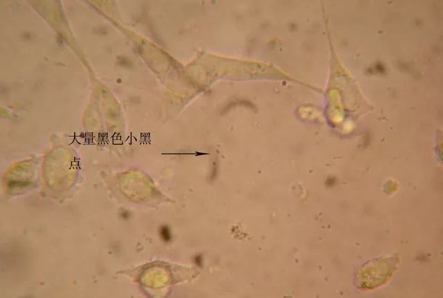 支原体 电镜图片