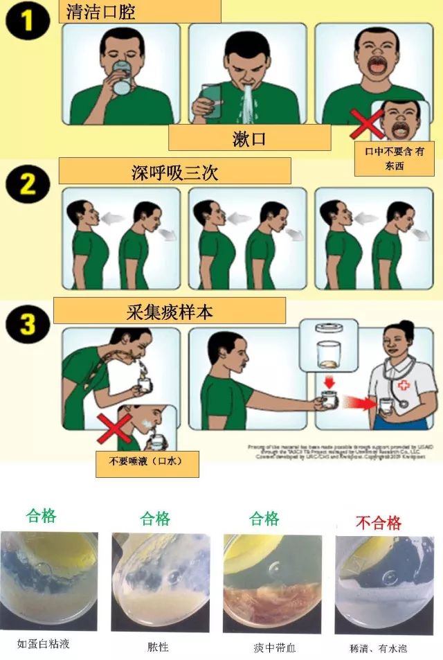 痰标本采集ppt图片