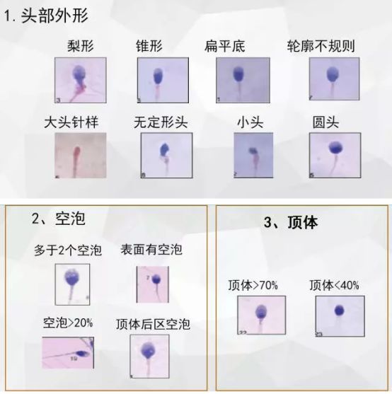 精子正常形态图片