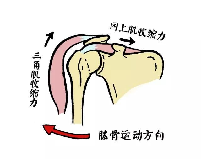 骨科医生说事儿肩膀痛抬不动肩袖损伤是元凶肩周炎不能老背锅上