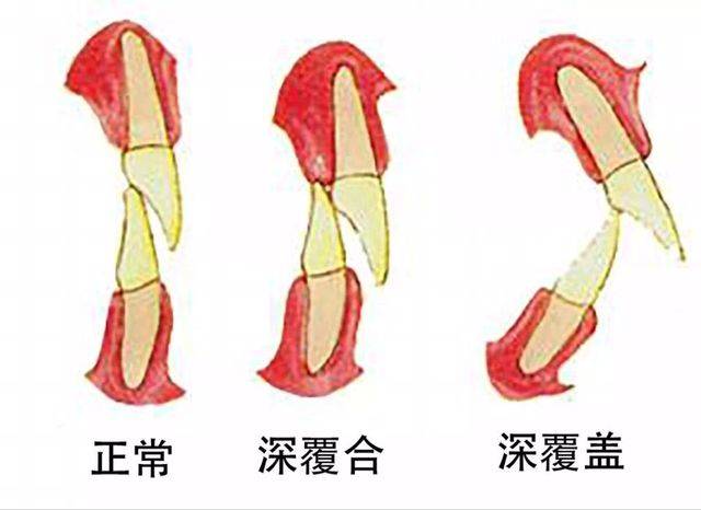 牙齒不整齊,對容貌的影響有多大?深圳市張志強口腔診所