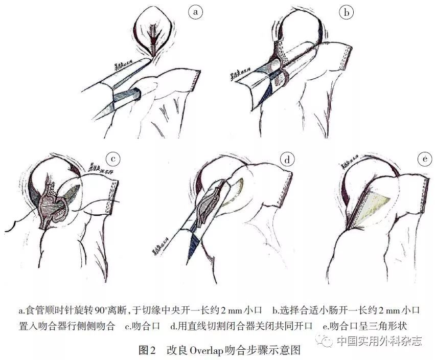 π吻合和overlap图片