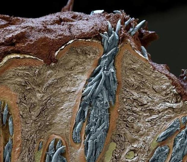 显微镜下的螨虫皮肤图片
