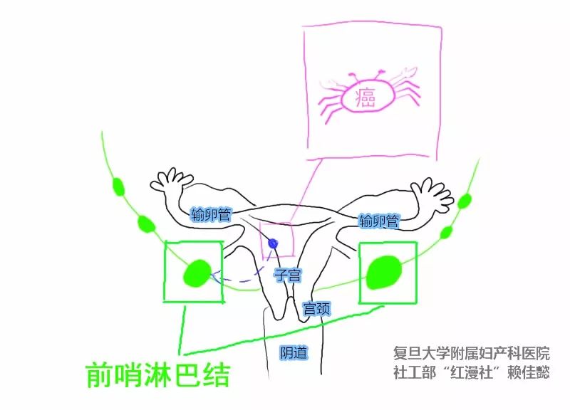 阴部淋巴结位置图图片