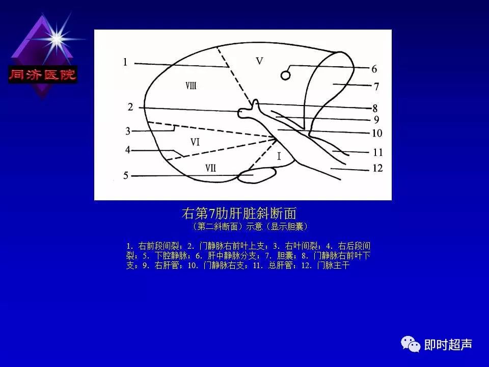 正常肝脏的超声解剖及局限病变的超声诊断