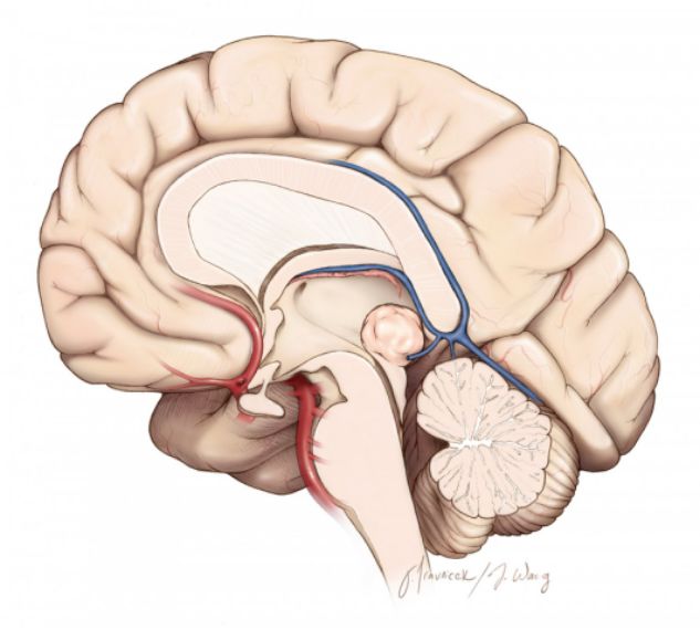 小腦上經腦室入路手術策略與技巧 | the neurosurgical atlas全文翻譯