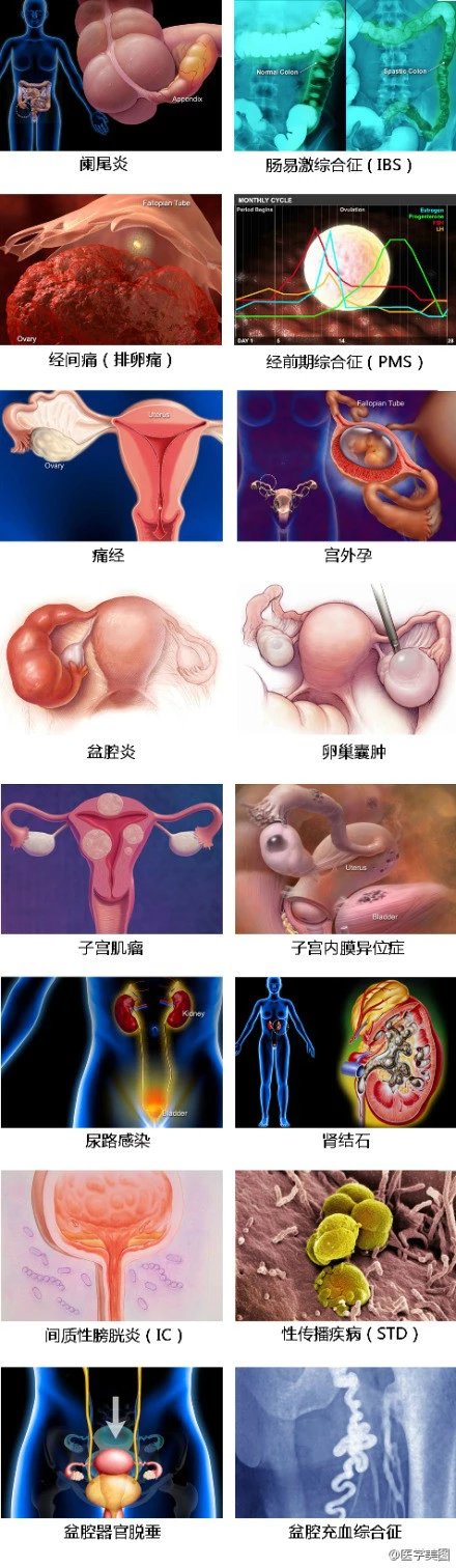 人工流產術33.妊娠期糖尿病34.乳腺癌的12個徵象35.妊娠激素變化36.