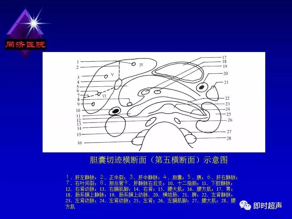 超声肝脏工字征图解图片