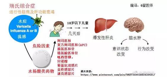 瑞夷综合症图片