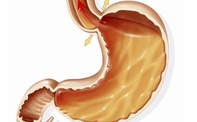 胃癌的五大早期症状，是什么原因导致的 得了胃癌还能活多久？能痊愈吗？