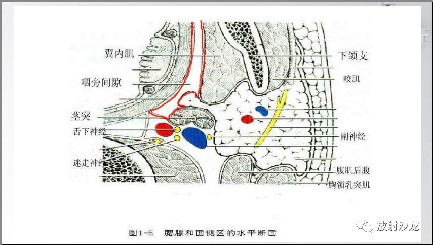 咽旁間隙常見腫瘤性病變影像診斷