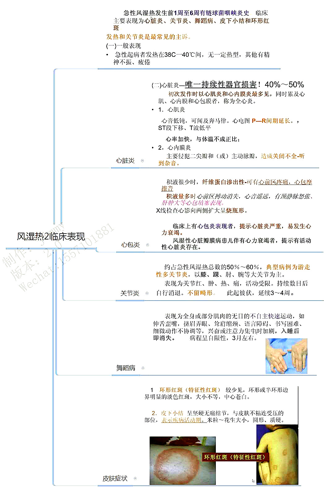 2018年最新執業醫師考試/考研思維導圖筆記兒科學:免疫系統疾病