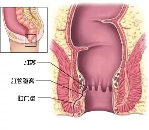 肛门内长了个肉条图解图片